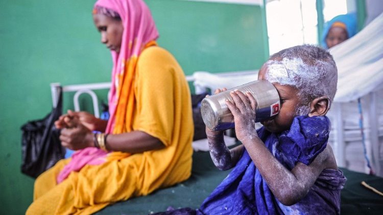 SOMALIA-REFUGEE-MALNUTRITION