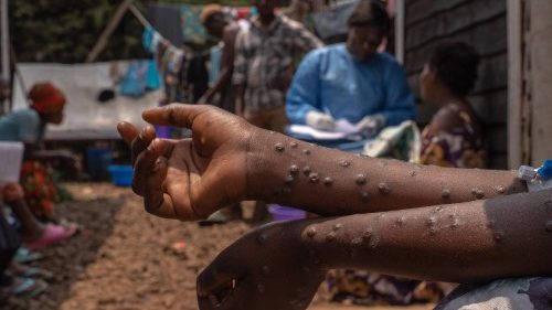 RD Congo, Msf: “Rischio crisi sanitaria per donne e neonati”