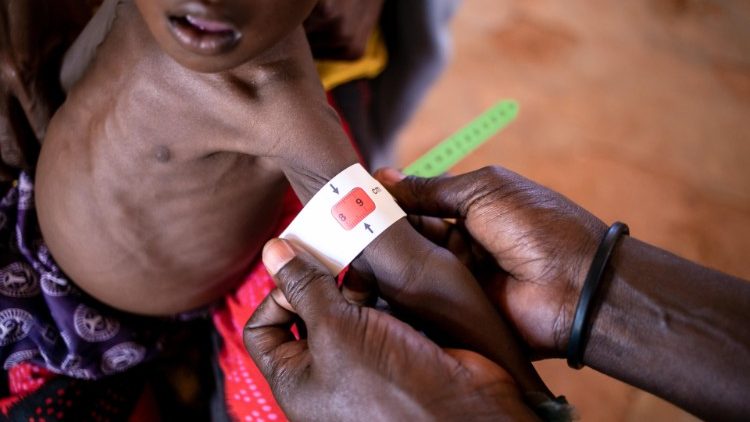 지난 8월 유니세프에 따르면 1분에 1명 꼴로 소말리아 어린이가 급성 영양실조로 입원했다. 