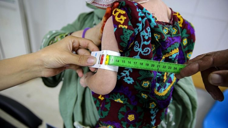 In einem Krankenhaus in Kabul wird ein unterernährtes Kind behandelt