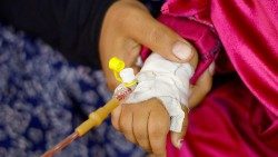 Palestinian children suffering from malnutrition receive treatment at al-Awda health centre, in Rafah, southern Gaza Strip