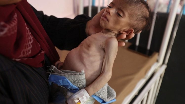 Hungerndes Kleinkind im Gazastreifen