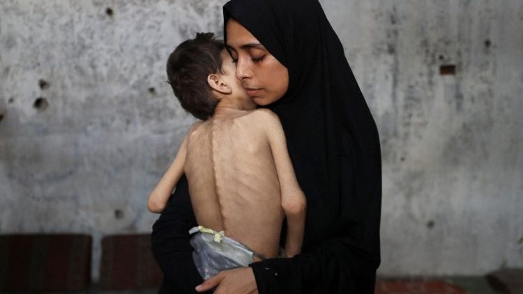 गाजा शहर में विस्थापित फिलिस्तीनी मां समाह मातर अपने कुपोषित बेटे यूसुफ को गोद में लिए हुए
