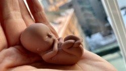 Należy wykorzystywać zasoby i energię w ochronę macierzyństwa, a nie zabijanie dzieci nienarodzonych