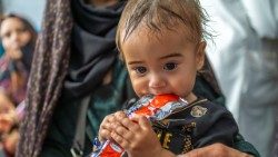 Rapporto Unicef sulla malnutrizione in Afghanistan